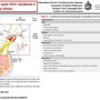 Meeting di Cardiologia all'Upo: focus sulla gestione dei disturbi della conduzione post-Tavi